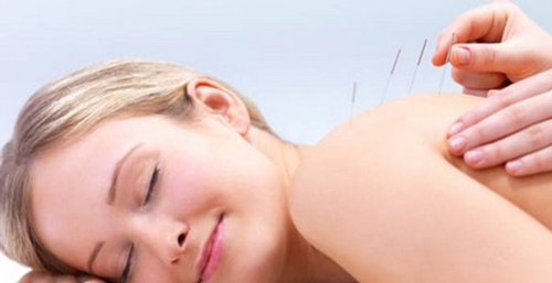 Acupuncture  for  pain  relief